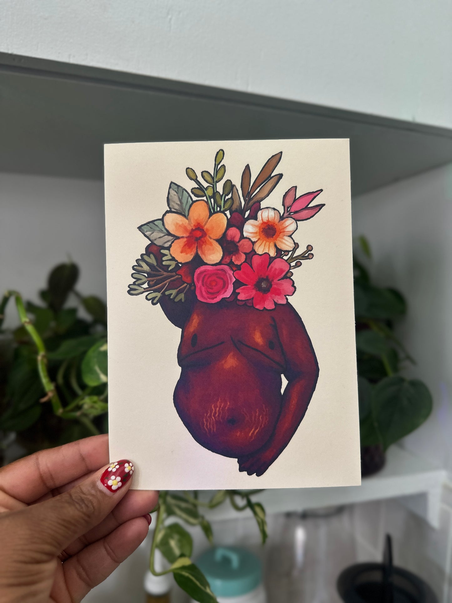 fat top surgery print