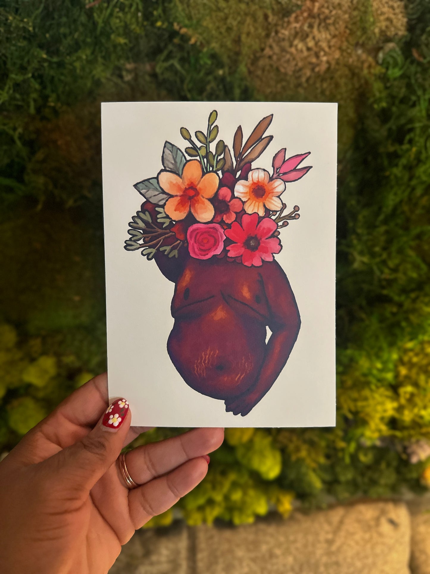 fat top surgery print